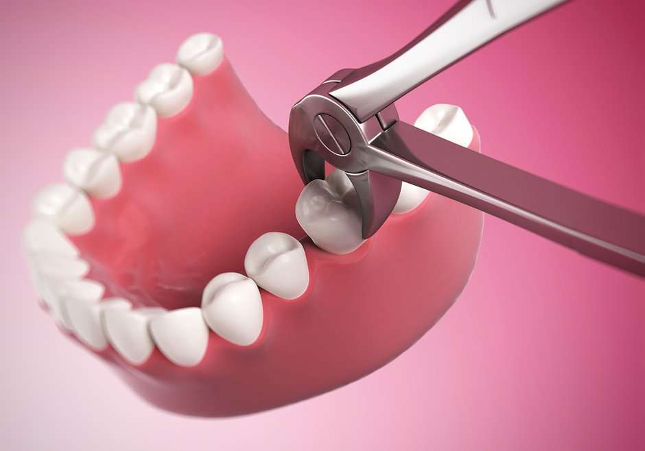 Можно ли лечить зубы во время месячных ?